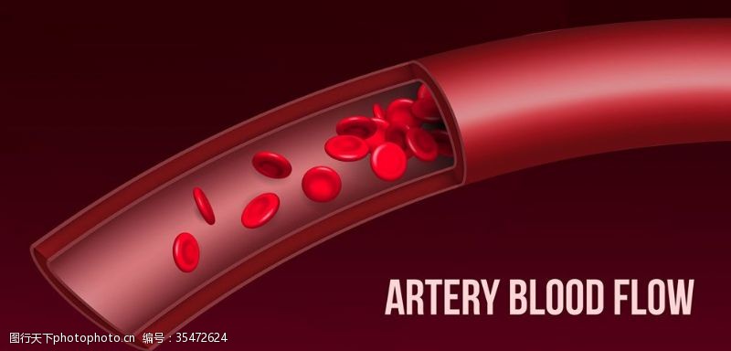 高血脂动脉血管