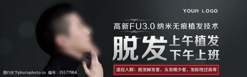 纳米无痕植发banner