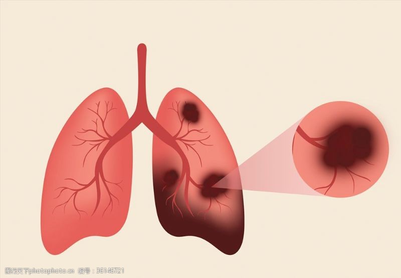 人体器官图肺部检查
