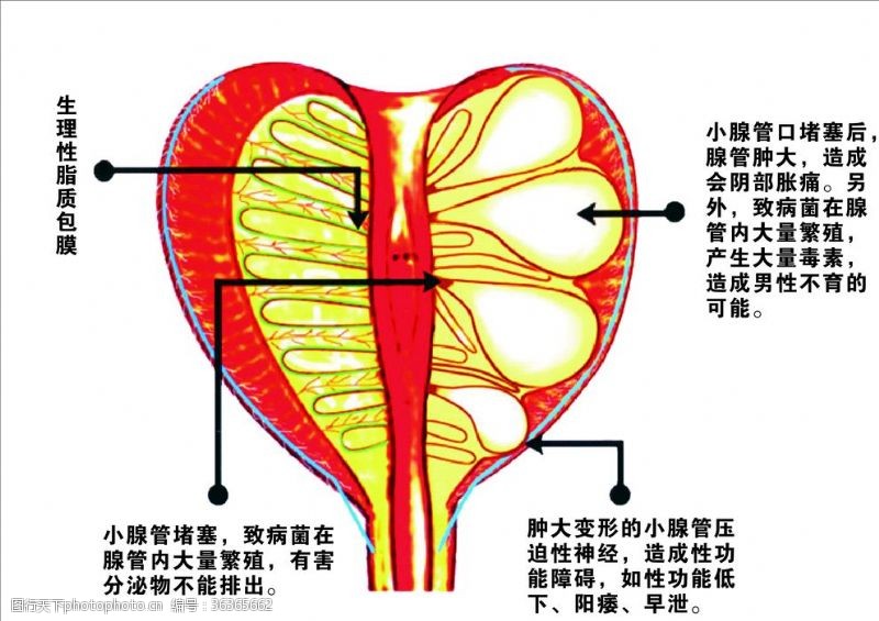 泌尿生殖科男性泌尿生殖系统解剖图