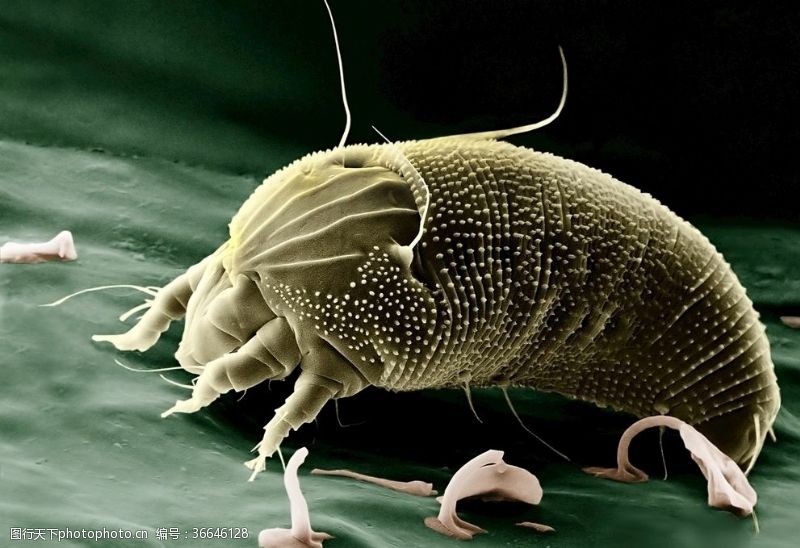 电子显微镜下的螨虫
