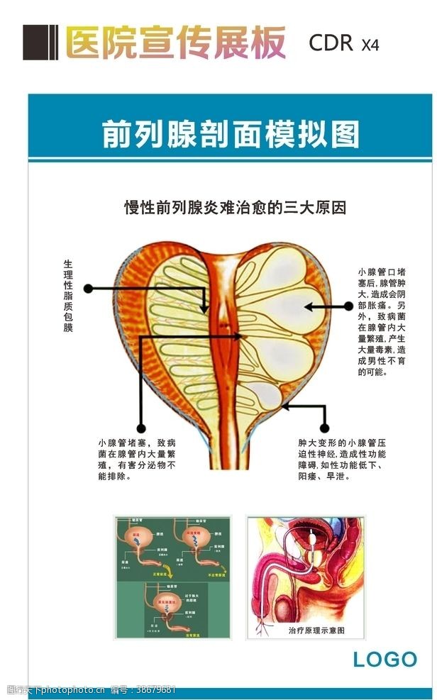 生殖系统图前列腺剖面模拟图