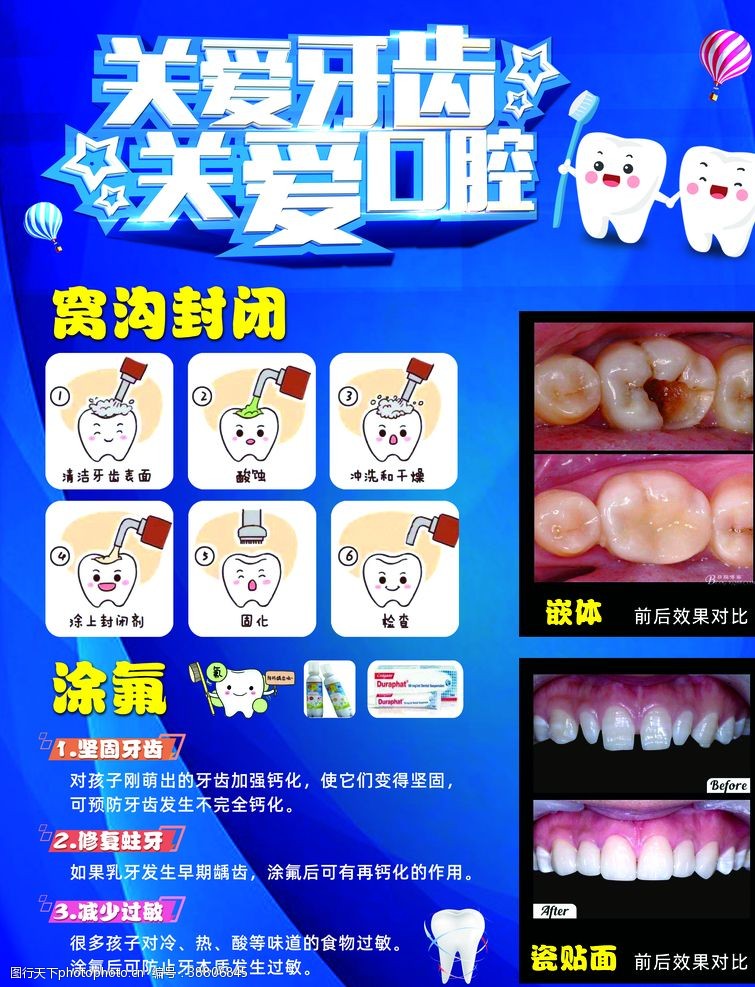 蛀牙牙科诊所海报
