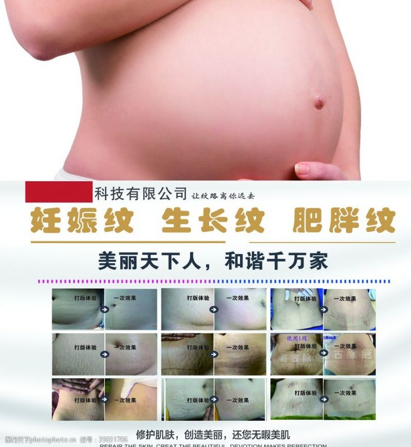 整形医疗妊娠纹海报图片