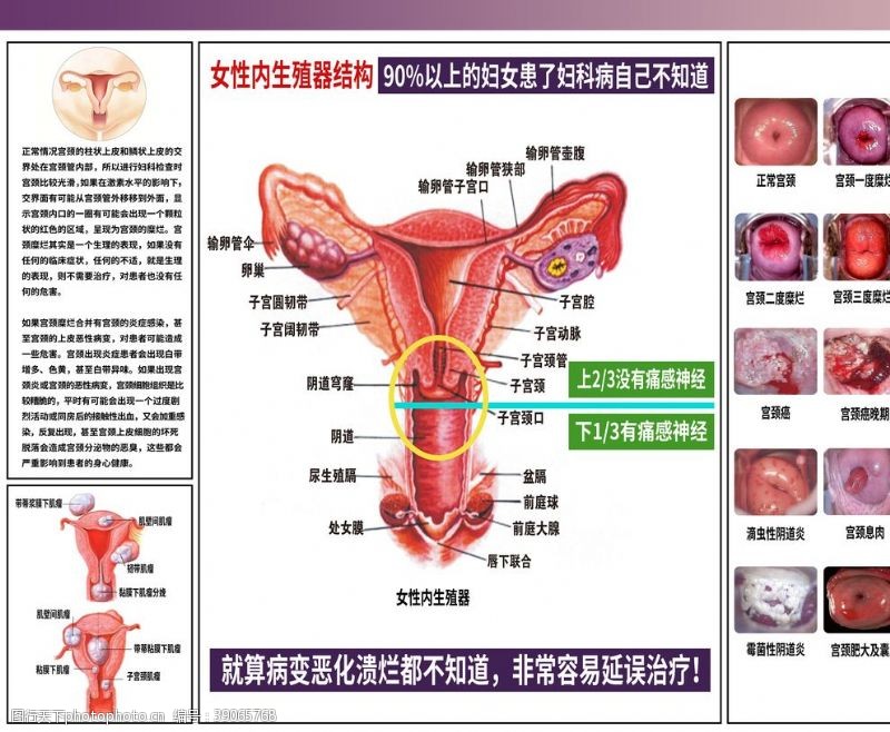 宫颈妇科病展板图片